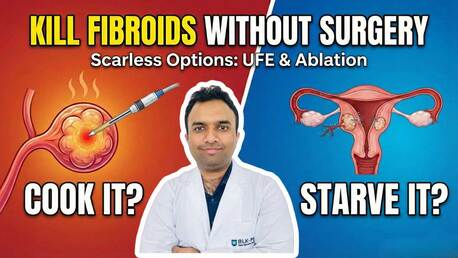Advanced Uterine Fibroids Treatment In Delhi NCR | Dr Akash Bansal