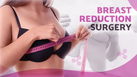 Looking For Breast Reduction Surgery In Delhi? Book A Consultation Today