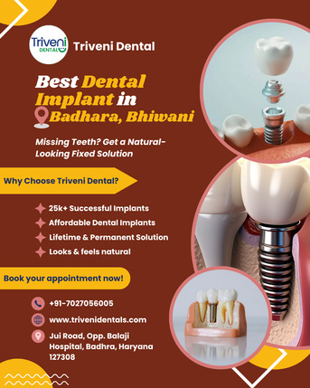 Best Doctors For Dental Implant In Badhara | Triveni Dental
