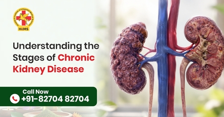 Natural Support For Chronic Kidney Disease | HiiMS Kidney Care photo 1