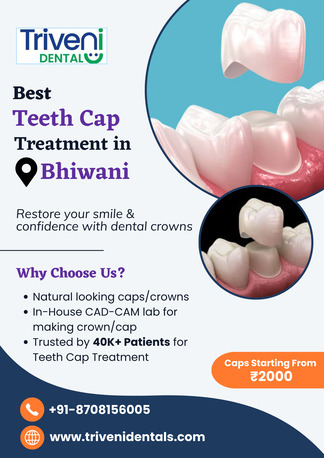 Best Teeth Cap (Crown) Treatment In Bhiwani | Triveni Dental photo 1
