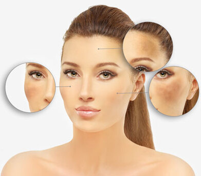 Pigmentation Treatment In Delhi | Skin Pigmentation Specialist