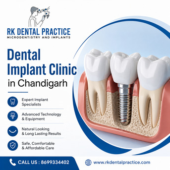 Dental Implant Clinic In Chandigarh For Advanced Tooth Replacement