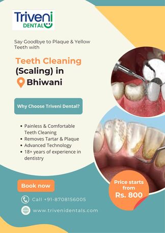 Teeth Cleaning (Scaling) In Bhiwani | Triveni Dental photo 1