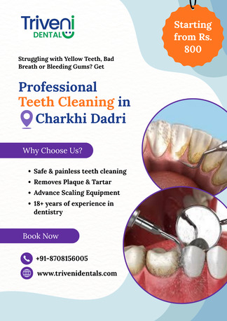 Best Teeth Cleaning (Scaling) In Charkhi Dadri | Triveni Dental photo 1
