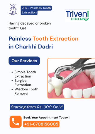Painless Tooth Extraction Treatment In Charkhi Dadri | Triveni Dental photo 1