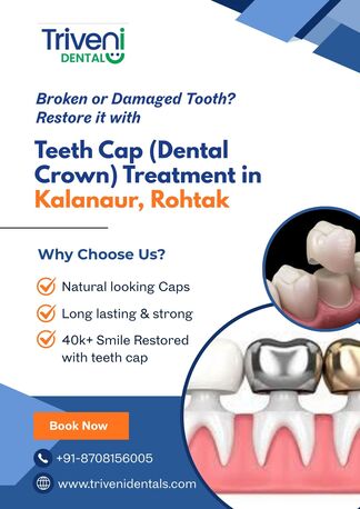 Teeth Cap Treatment In Kalanaur, Rohtak | Triveni Dental photo 1