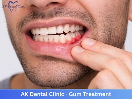 Professional Dentist In Vile Parle West, Mumbai | AK Dental Clinic