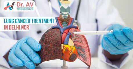 Trusted Lung Cancer Treatment In Delhi NCR With Advanced Therapies photo 1