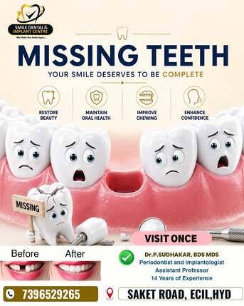 Get Permanent Teeth: Affordable Dental Implants Cost In Hyderabad photo 1