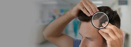 INR 500000,  Breathe New Life Into Your Scalp! photo 1