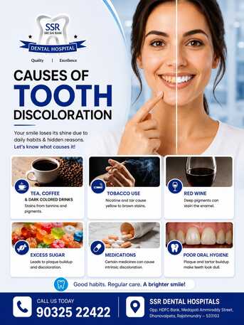Causes Of Tooth Discoloration – Expert Dental Care By SSR Dental Hospital