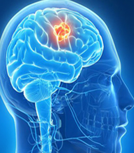 Best Brain Surgeon In Byrathi photo 1