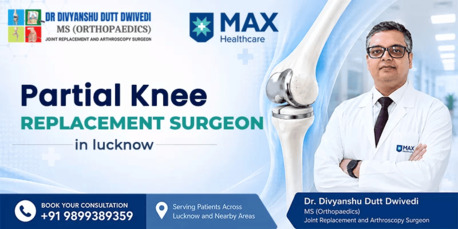 Best Partial Knee Replacement Specialist In Lucknow