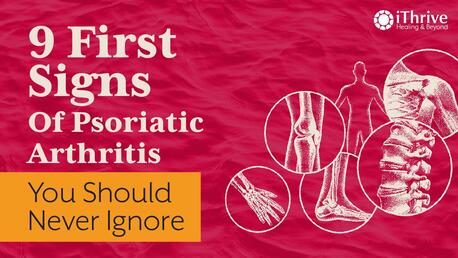 The Gut-skin-joint Connection Behind Psoriatic Arthritis That Most People Never Learn Abou