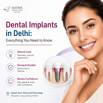 Dental Implants In Delhi: Everything You Need To Know