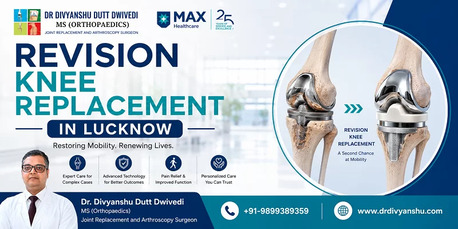 Experienced Revision Knee Replacement Surgeon In Lucknow photo 1