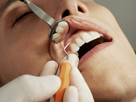 Affordable Dentist Near Me | Low-Cost Dental Clinic In Gorakhpur