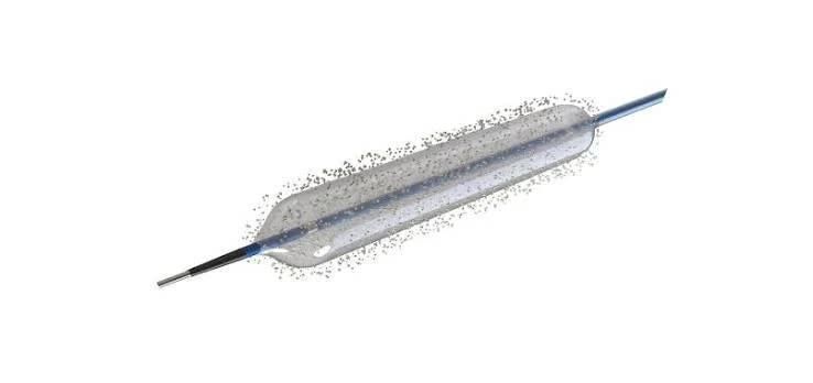 Drug Coated Balloon For In-Stent Restenosis Treatment